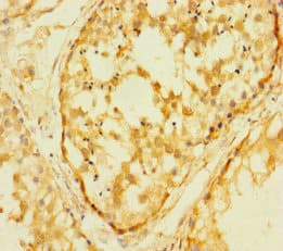 FAM127C Antibody