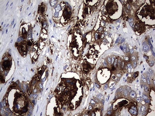 CEACAM5 / CD66e Antibody (aa35-680, clone OTI2B12)
