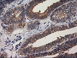 GBA3 / CBG Antibody (clone OTI1F1)