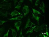 Monoclonal Mouse anti-Human MARS Antibody (clone MARSD10B4, IF, WB)