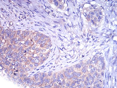 TH / Tyrosine Hydroxylase Antibody (clone 1B8D2)