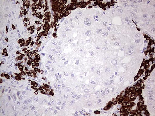 GLI / GLI1 Antibody (aa1-410, clone UMAB170)