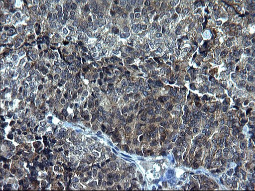 KITLG / SCF Antibody (clone OTI5F6)