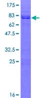 Human LHX2 Protein (Recombinant GST)