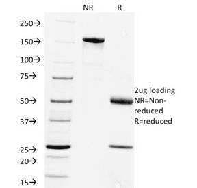 Rabies Virus Antibody (clone Rab-50, Azide-free, BSA-free)