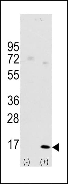 Polyclonal Rabbit anti-Human MAP1LC3A / LC3A Antibody (aa91-117, IF, WB)