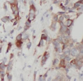 NAMPT / Visfatin Antibody