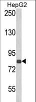 Polyclonal Rabbit anti-Human ECE-1 Antibody (aa391-420, IHC, WB)
