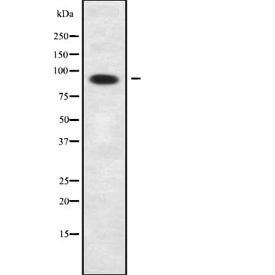 Polyclonal Rabbit anti-Human PPP1R9B / Spinophilin Antibody (IHC, WB)