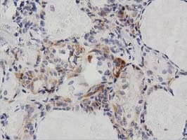 PECR Antibody (clone OTI2B2)