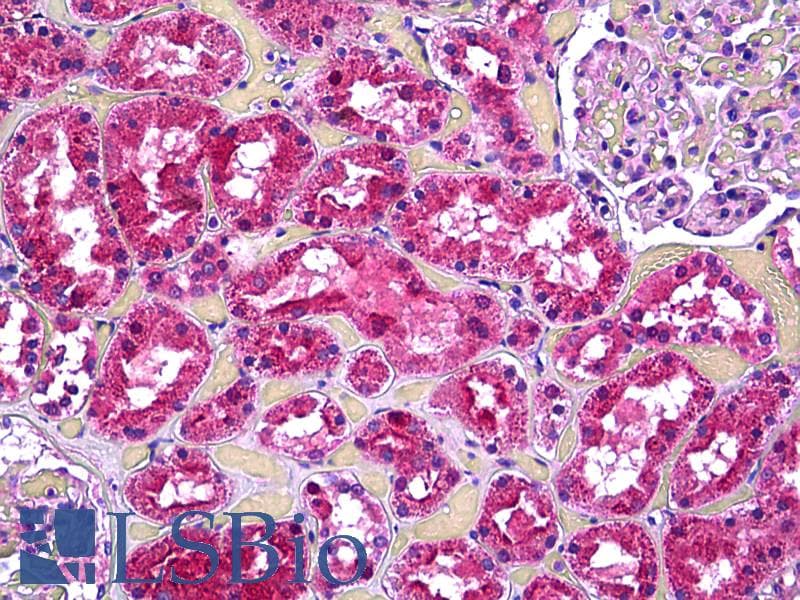 IHC-plus™ VCL / Vinculin Antibody (aa786-835)