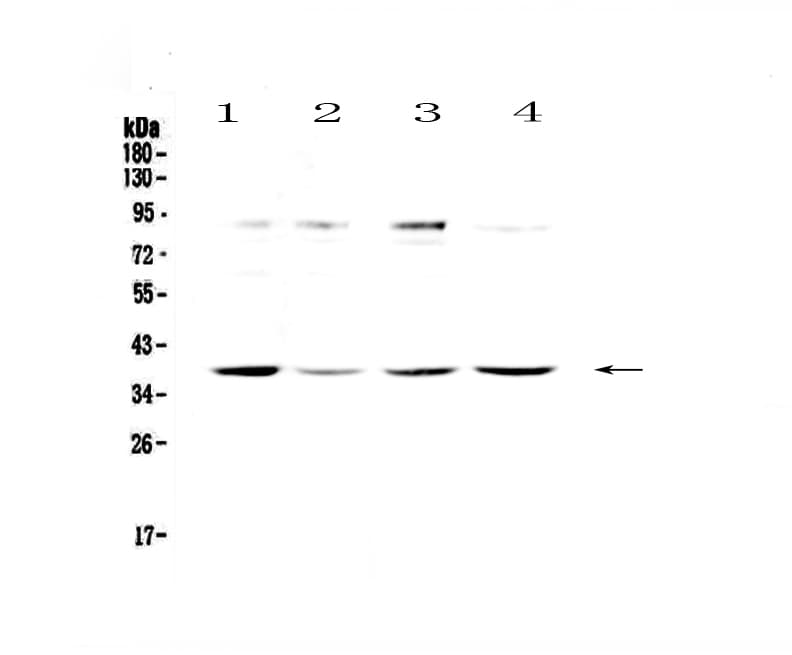 Polyclonal Rabbit anti-Human OGG1 Antibody (WB)