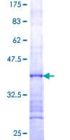 Human UTP14A Protein (Recombinant GST, N-terminus)