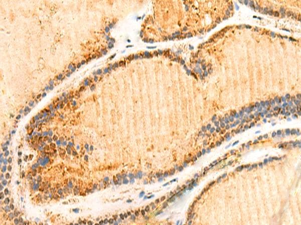 Polyclonal Rabbit anti-Human ZNF581 Antibody (IHC)