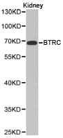 BTRCP / BETA-TRCP Antibody