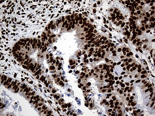 Monoclonal Mouse anti-Human PTBP3 / ROD1 Antibody (clone OTI5G7, aa300-552, IHC, WB)