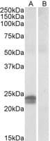 IHC-plus™ HMGIY / HMGA1 Antibody (aa9-21)