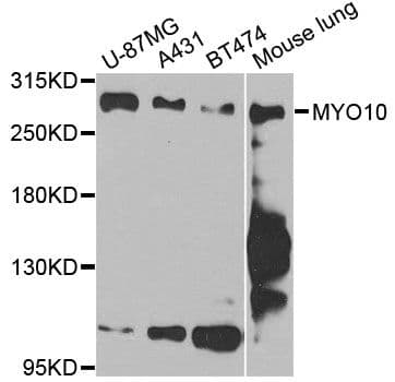 MYO10 / Myosin-X Antibody