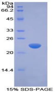 Rabbit IFN Beta / Interferon Beta Protein (Recombinant His-T7)