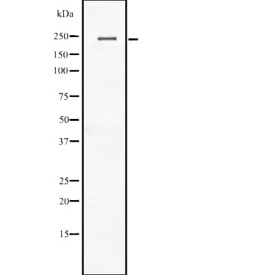 Polyclonal Rabbit anti-Human CACNA1C / Cav1.2 Antibody (WB)