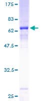 Human CDK6 Protein (Recombinant GST)