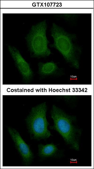 OSBPL6 Antibody (aa872-934)