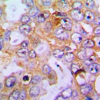 Polyclonal Rabbit anti-Human Endostatin Antibody (C-Terminus, IHC, WB)