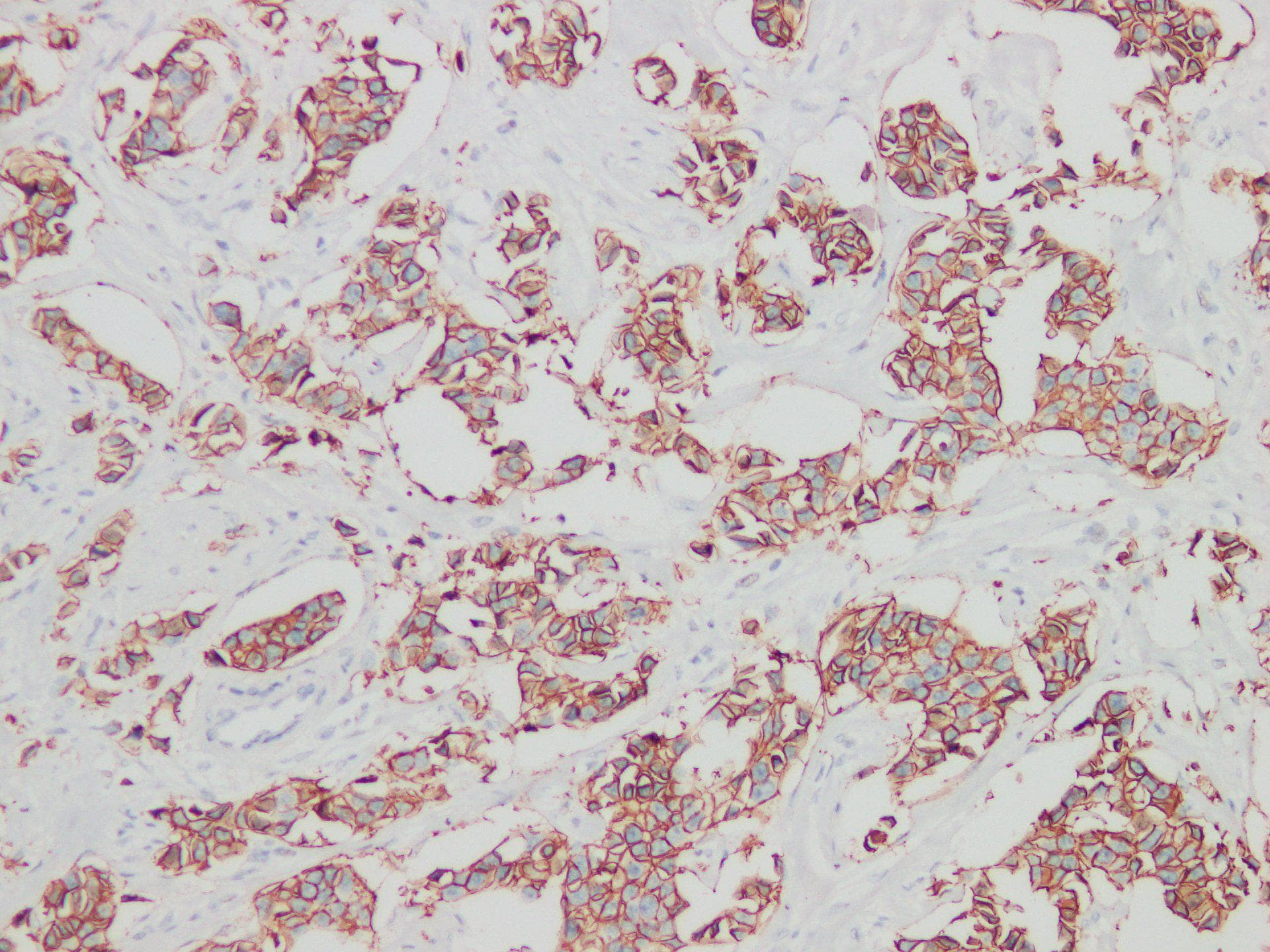 Monoclonal Mouse HER2/neu Fragment (869-877) Antibody (IHC)