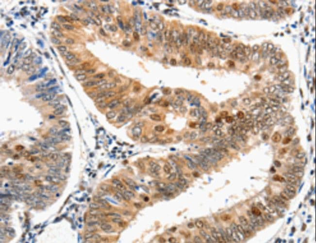 DDB1 Antibody