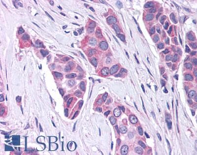 PathPlus™ Polyclonal Rabbit anti-Human GPER1 / GPR30 Antibody (C-Terminus, IHC, IF, WB)
