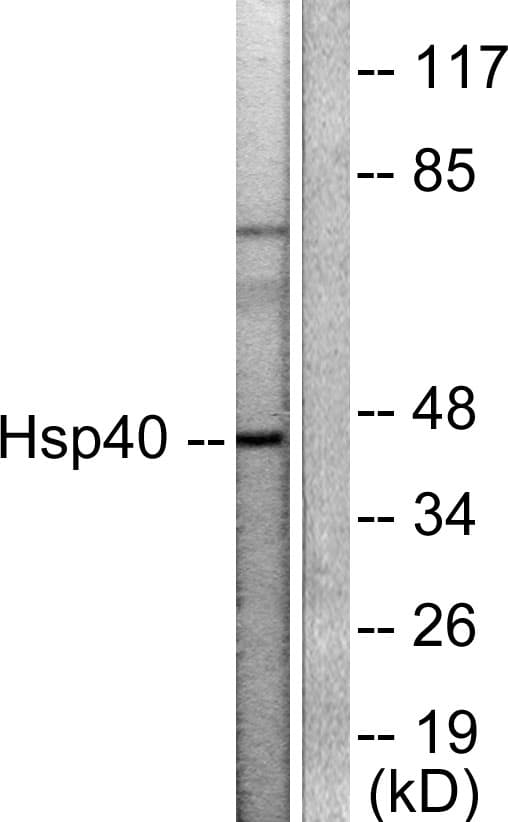 Polyclonal Rabbit anti-Human DNAJB1 / Hsp40 Antibody (aa271-320, IHC, IF, WB)