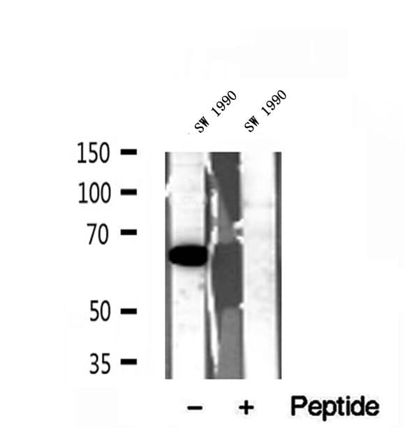 QSOX1 / QSCN6 Antibody