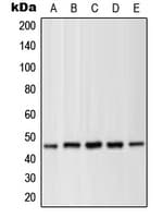 MAP2K1 / MKK1 / MEK1 Antibody (phospho-Thr286)