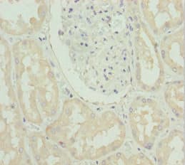 SLC39A4 / ZIP4 Antibody