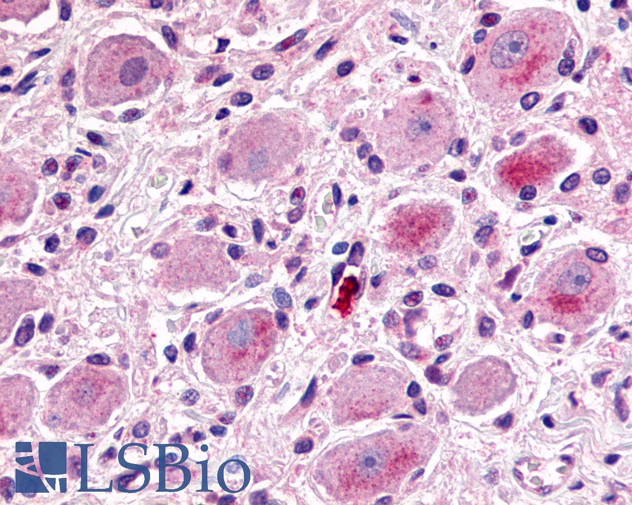 IHC-plus™ Polyclonal Rabbit anti-Human MRGX1 / MRGPRX1 Antibody (N-Terminus, IHC)