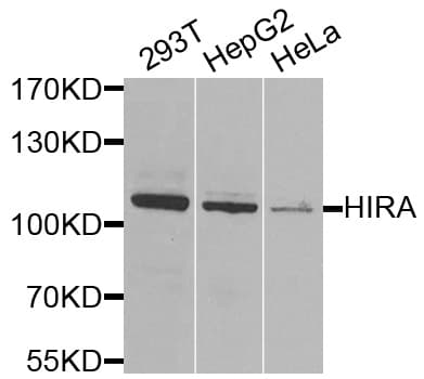 Polyclonal Rabbit anti-Human HIRA Antibody (IHC, WB)