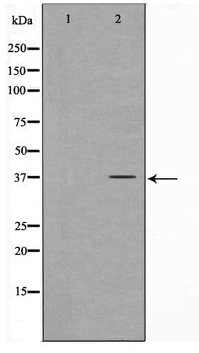 FOXL1 Antibody