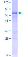 Human PDX1 Protein (Recombinant GST)