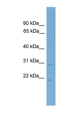 TNRC5 / CNPY3 Antibody (N-Terminus)