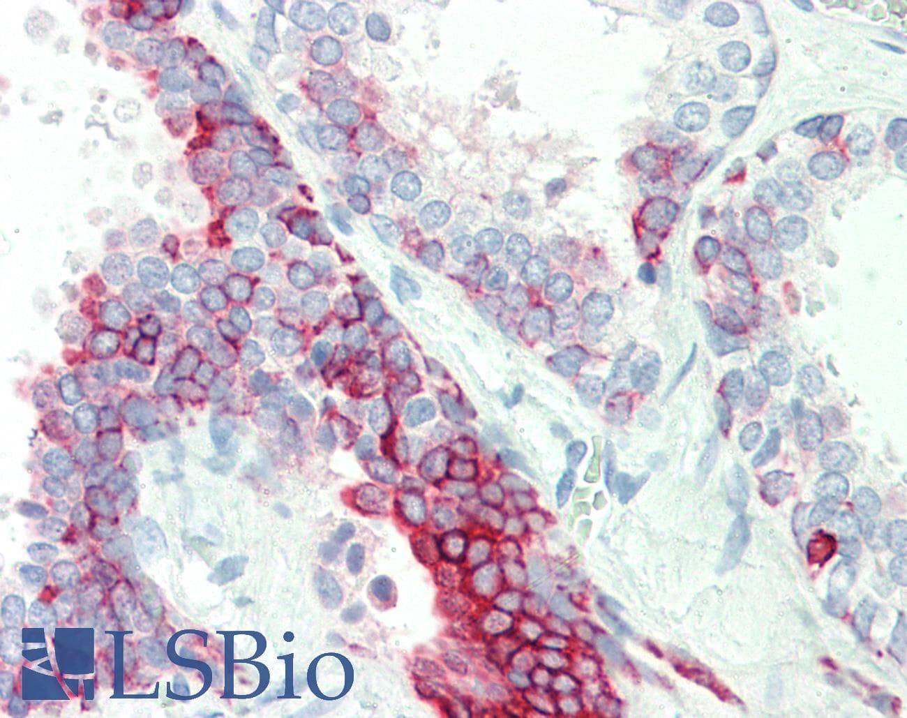 Polyclonal Rabbit anti-Human KRT7 / CK7 / Cytokeratin 7 Antibody (N-Terminus, IHC, WB)
