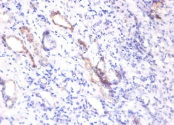 Polyclonal Rabbit anti-Human SPP1 / Osteopontin Antibody (IHC, WB)