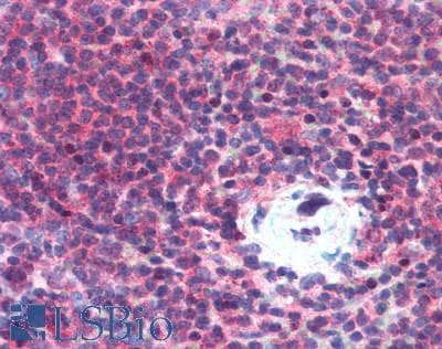 ADAM8 Antibody (aa145-493)