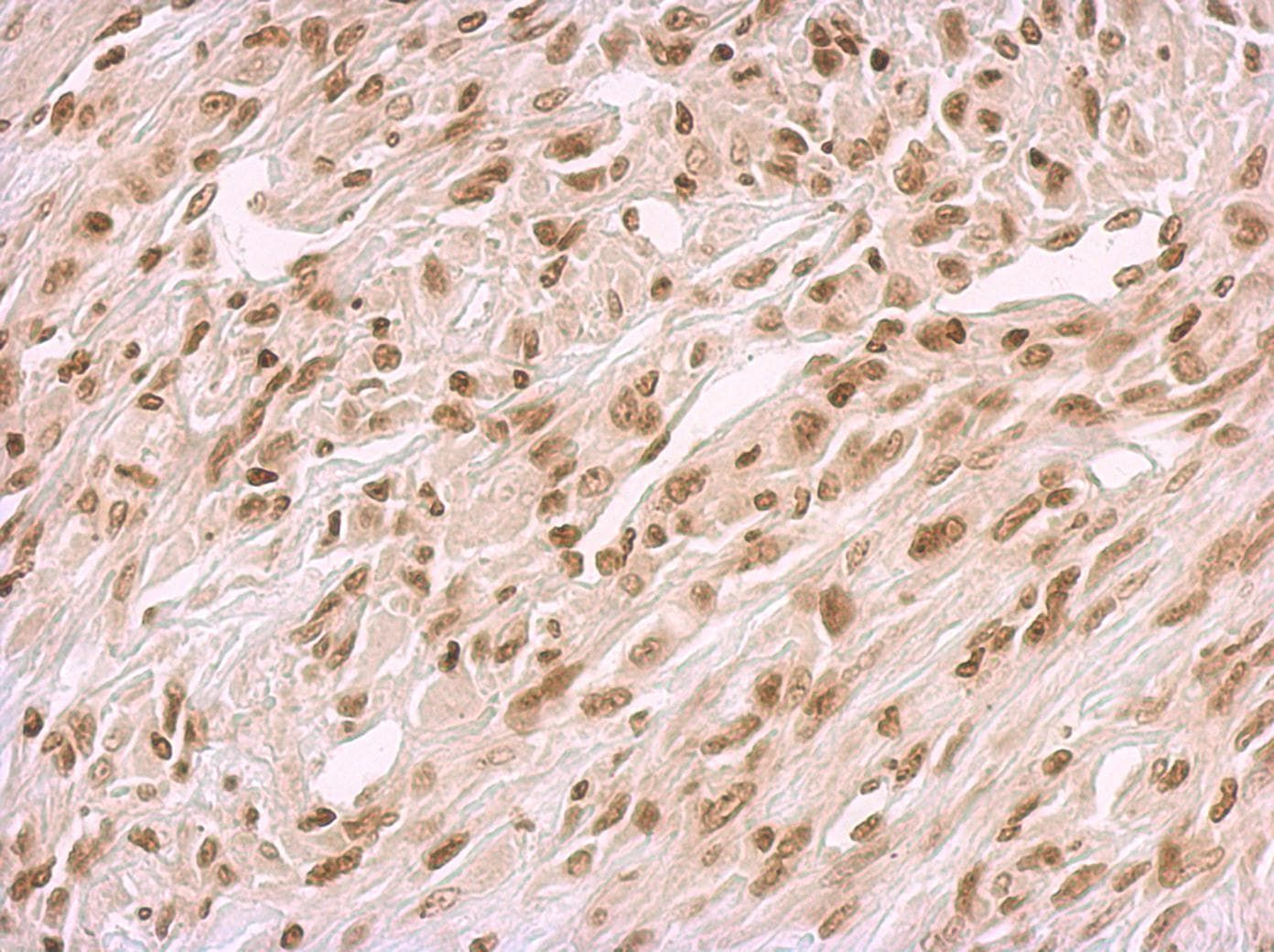 Polyclonal Rabbit anti-Human BCCIP Antibody (aa181-273, IHC, WB)