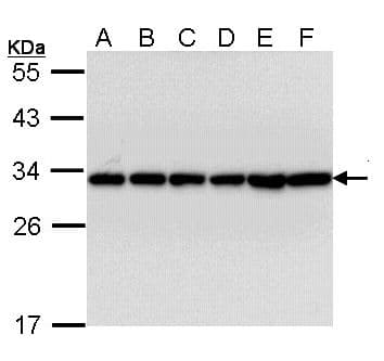 IHC-plus™ Polyclonal Rabbit anti-Human YWHAB / 14-3-3 Beta Antibody (IHC, IF, WB)
