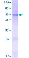Human TMEM39B Protein (Recombinant GST)