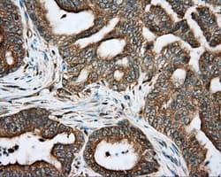 RDH11 Antibody (clone OTI1B4)