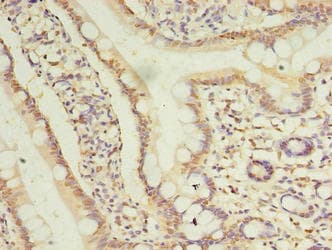 Polyclonal Rabbit anti-Human TRIM15 Antibody (IHC, WB)