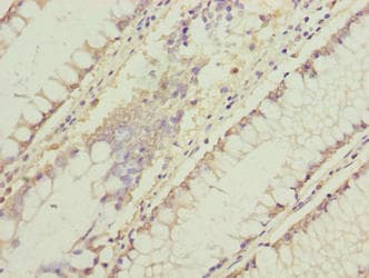 Polyclonal Rabbit anti-Human C11orf53 Antibody (IHC, WB)