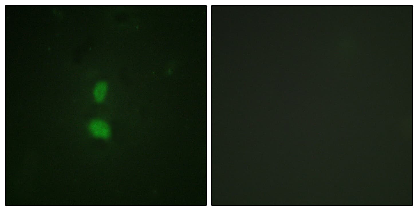 SNAI1 / SNAIL-1 Antibody (phospho-Ser246)