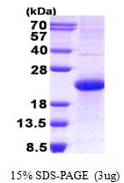 Human NBL1 / DAN Protein (Recombinant His)